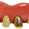 Teeth Gold